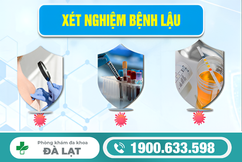 Hình ảnh minh họa